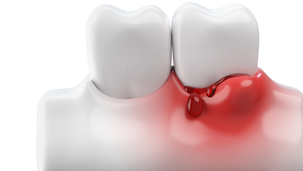 Periodontics