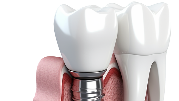 Implantology